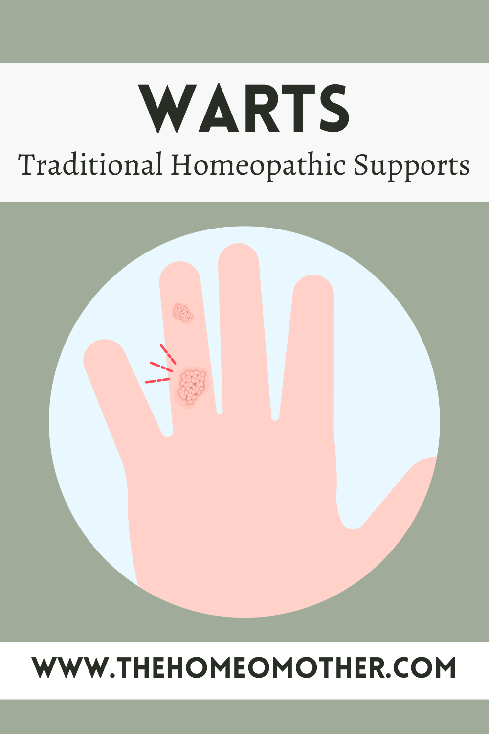 Warts: Traditional Homeopathic Supports